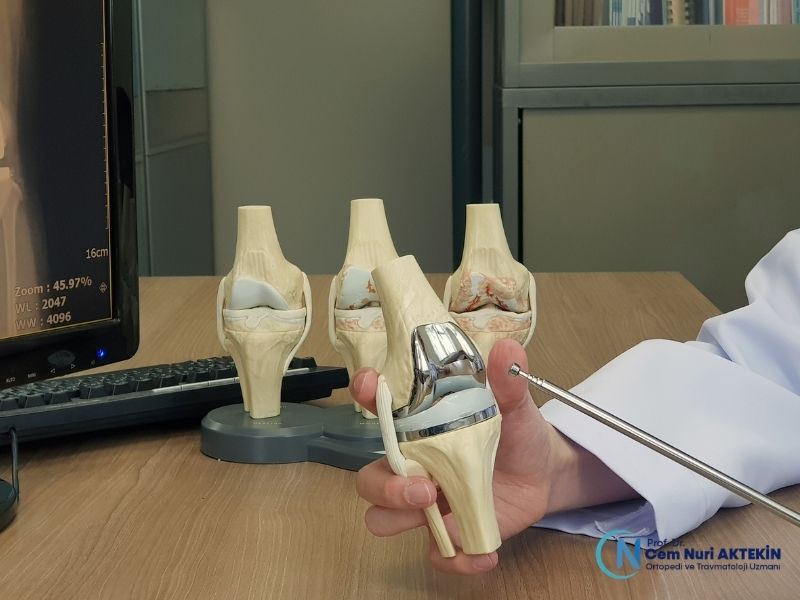 diz-protezi-nedir-temel-kavramlari-anlamak